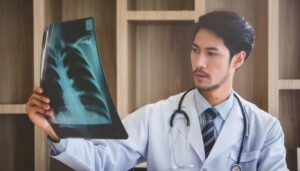 胸部のX線写真を注視する髭を蓄えた短髪の30代男性医師